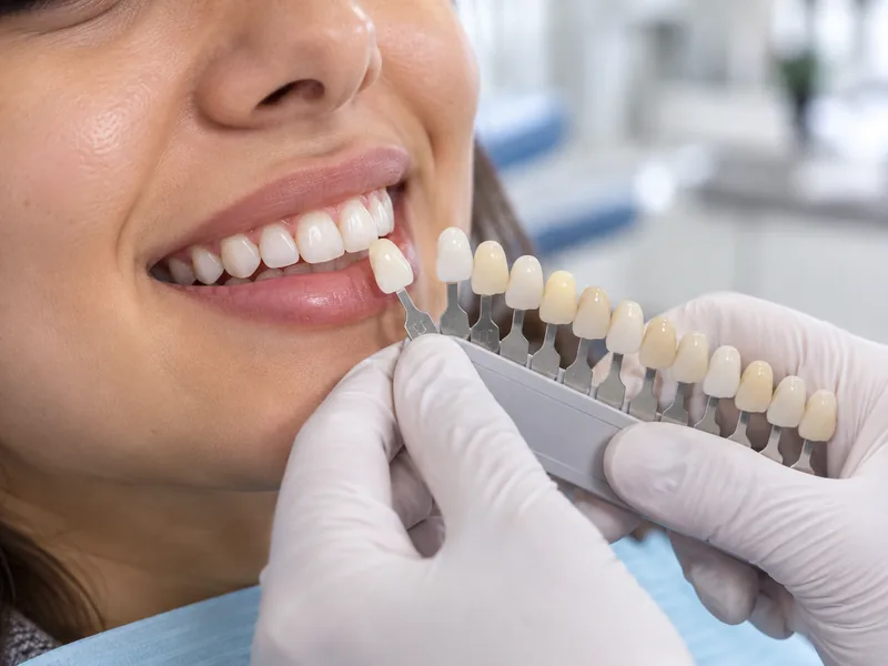 Dental Crowns & Caps at SR Multispeciality Dental Clinic, Gajularamaram